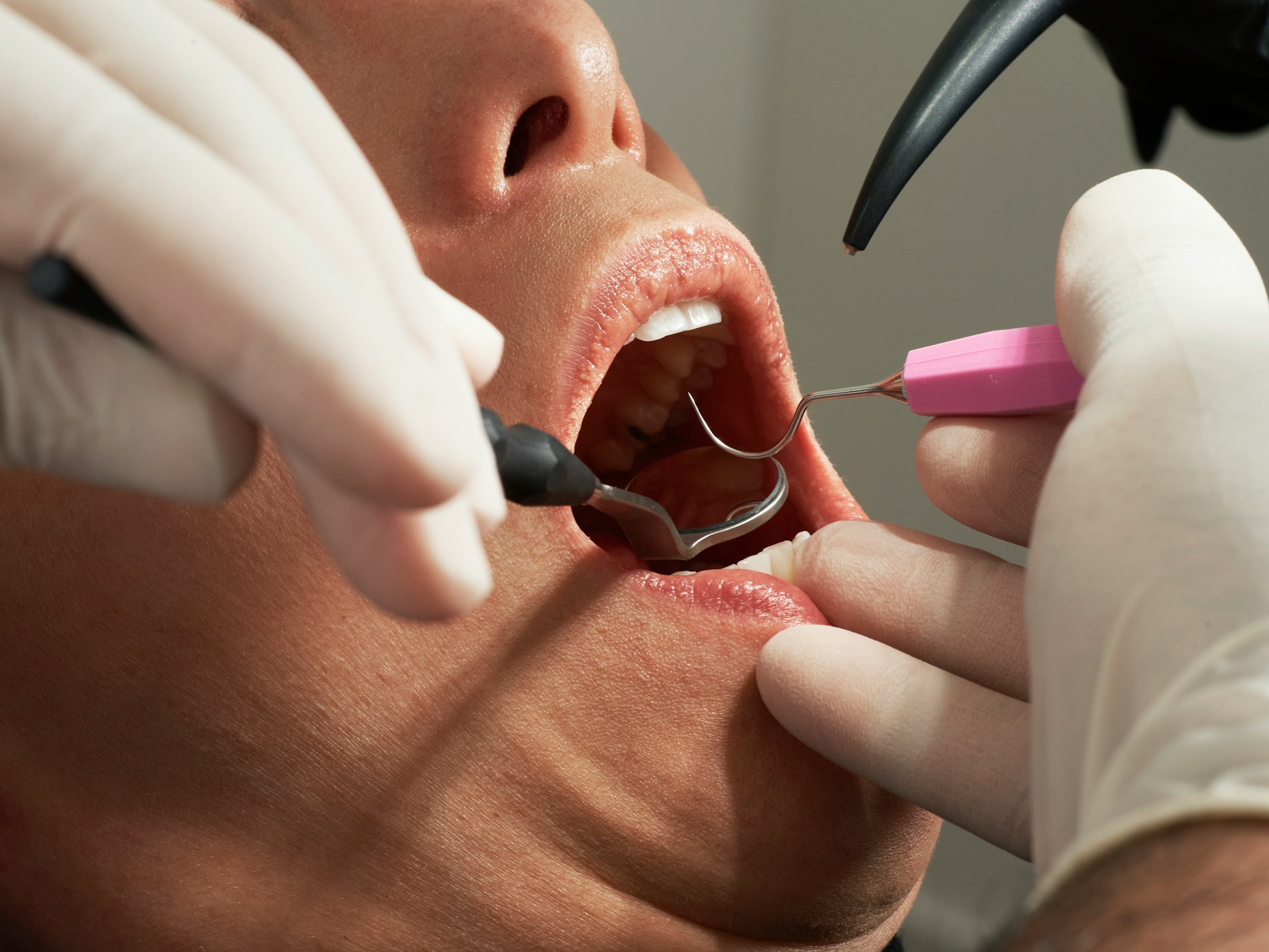 Quand consulter un dentiste en urgence ?